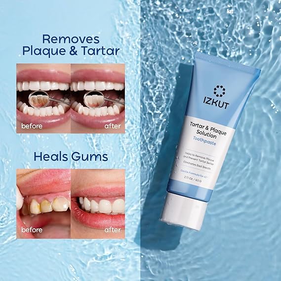 Plaque & Tartar Remover Toothpaste for Teeth: Removes Plaque & Controls Tartar Build-up - Long-Lasting Fresh Breath, Deep Cleansing & Gum-Friendly Formula, Enamel Support Toothpaste for Adults & Kids